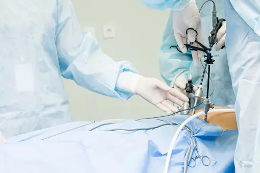 LAPAROSCOPIC STERILIZATION